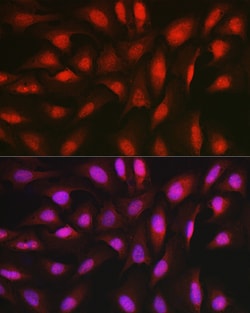 Invitrogen AKT1 Polyclonal Antibody 100 &mu;L; Unconjugated:Antibodies,