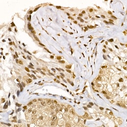Invitrogen AKT1 Polyclonal Antibody 100 &mu;L; Unconjugated:Antibodies,