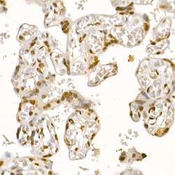 Invitrogen AKT1 Polyclonal Antibody 100 &mu;L; Unconjugated:Antibodies,