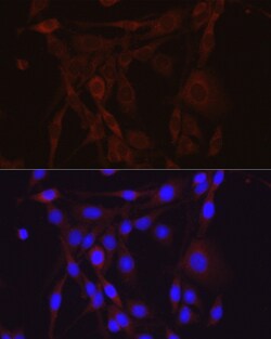 Invitrogen alpha-ENaC Polyclonal Antibody 100 &mu;L; Unconjugated:Antibodies,