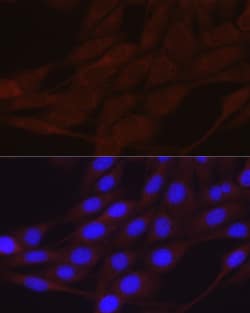 Invitrogen alpha-ENaC Polyclonal Antibody 100 &mu;L; Unconjugated:Antibodies,