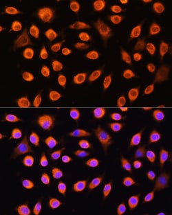 Invitrogen GNAS Polyclonal Antibody 100 &mu;L; Unconjugated:Antibodies,
