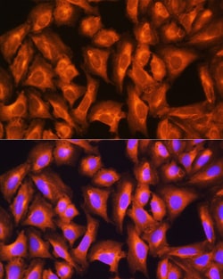 Invitrogen GNAS Polyclonal Antibody 100 &mu;L; Unconjugated:Antibodies,