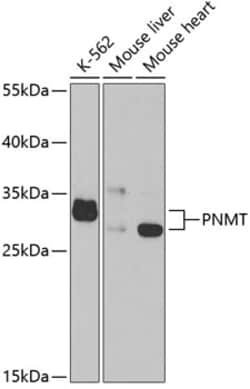Invitrogen PNMT Polyclonal Antibody 100 &mu;L | Buy Online | Invitrogen&trade; | Fisher Scientific