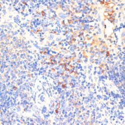Invitrogen WNK3 Polyclonal Antibody 100 &mu;L | Buy Online | Invitrogen&trade; | Fisher Scientific