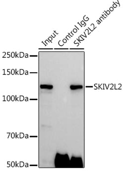 Invitrogen SKIV2L2 Polyclonal Antibody 100 &mu;L; Unconjugated:Antibodies,