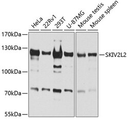 Invitrogen SKIV2L2 Polyclonal Antibody 100 &mu;L; Unconjugated:Antibodies,