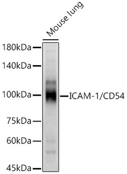 Invitrogen ICAM-1 Polyclonal Antibody 100 &mu;L | Buy Online | Invitrogen&trade; | Fisher Scientific