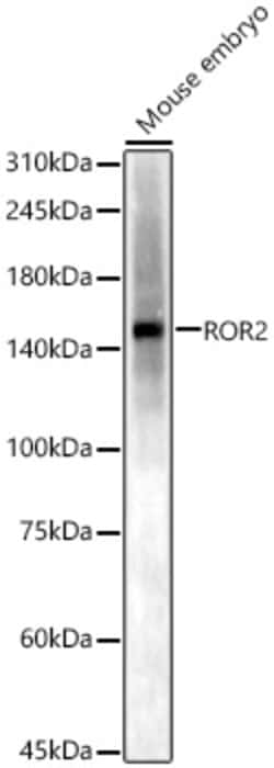 Invitrogen ROR2 Polyclonal Antibody 100 &mu;L; Unconjugated:Antibodies,