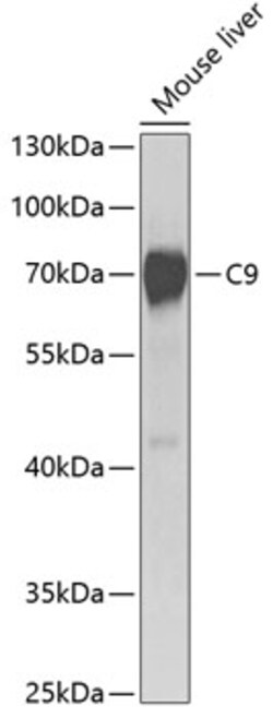 Invitrogen Complement C9 Polyclonal Antibody 100 &mu;L; Unconjugated:Antibodies,