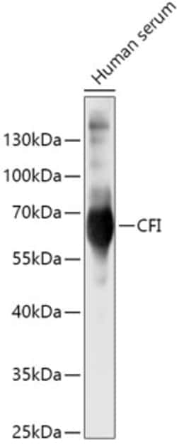 Invitrogen Complement Factor I Polyclonal Antibody 100 &mu;L; Unconjugated:Antibodies,