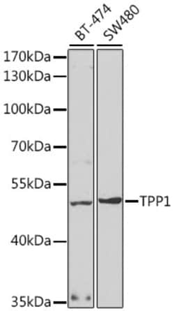 Invitrogen CLN2 Polyclonal Antibody 100 &mu;L; Unconjugated:Antibodies,