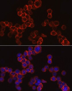 Invitrogen Cathepsin G Polyclonal Antibody 100 &mu;L | Buy Online | Invitrogen&trade; | Fisher Scientific