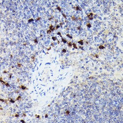 Invitrogen Cathepsin G Polyclonal Antibody 100 &mu;L | Buy Online | Invitrogen&trade; | Fisher Scientific