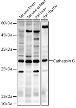 Invitrogen Cathepsin G Polyclonal Antibody 100 &mu;L | Buy Online | Invitrogen&trade; | Fisher Scientific