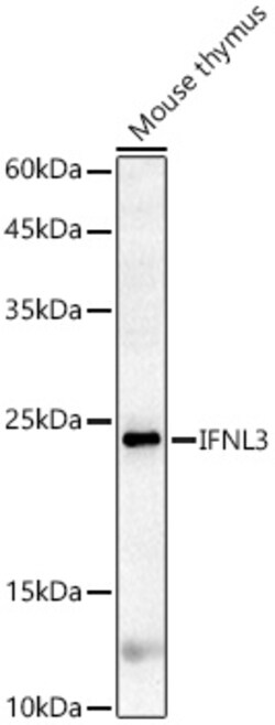 Invitrogen IL-28B Polyclonal Antibody 100 &mu;L; Unconjugated:Antibodies,