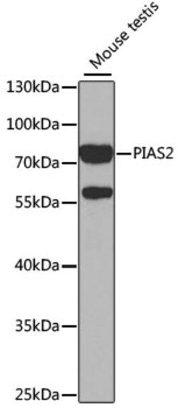 Invitrogen PIAS2 Polyclonal Antibody 100 &mu;L | Buy Online | Invitrogen&trade; | Fisher Scientific