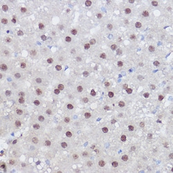 Invitrogen PPAR delta Polyclonal Antibody 100 &mu;L | Buy Online | Invitrogen&trade; | Fisher Scientific
