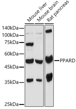 Invitrogen PPAR delta Polyclonal Antibody 100 &mu;L | Buy Online | Invitrogen&trade; | Fisher Scientific
