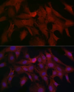 Invitrogen SMAD4 Polyclonal Antibody 100 &mu;L; Unconjugated:Antibodies,
