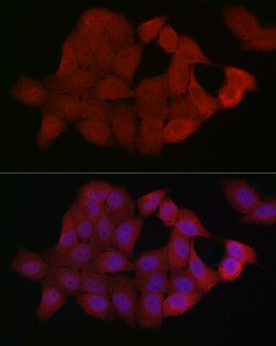 Invitrogen SMAD4 Polyclonal Antibody 100 &mu;L; Unconjugated:Antibodies,