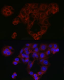 Invitrogen SMAD4 Polyclonal Antibody 100 &mu;L; Unconjugated:Antibodies,