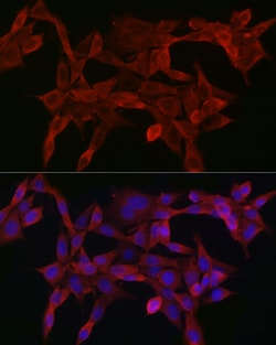 Invitrogen SMAD4 Polyclonal Antibody 100 &mu;L; Unconjugated:Antibodies,