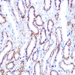 Invitrogen SMAD4 Polyclonal Antibody 100 &mu;L; Unconjugated:Antibodies,