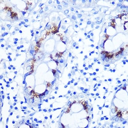 Invitrogen SMAD4 Polyclonal Antibody 100 &mu;L; Unconjugated:Antibodies,