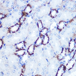 Invitrogen SMAD4 Polyclonal Antibody 100 &mu;L; Unconjugated:Antibodies,