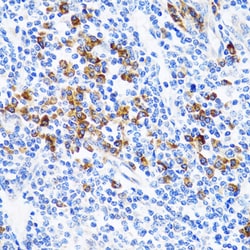 Invitrogen TWEAK Polyclonal Antibody 100 &mu;L; Unconjugated:Antibodies,