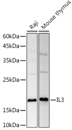 Invitrogen IL-3 Polyclonal Antibody 100 &mu;L | Buy Online | Invitrogen&trade; | Fisher Scientific