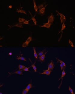 Invitrogen IQGAP1 Polyclonal Antibody 100 &mu;L; Unconjugated:Antibodies,