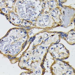 Invitrogen IQGAP1 Polyclonal Antibody 100 &mu;L; Unconjugated:Antibodies,