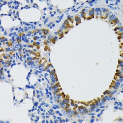 Invitrogen IQGAP1 Polyclonal Antibody 100 &mu;L; Unconjugated:Antibodies,