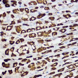 Invitrogen BNIP3 Polyclonal Antibody 100 &mu;L; Unconjugated:Antibodies,