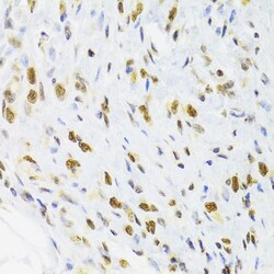 Invitrogen DOK1 Polyclonal Antibody 100 &mu;L | Buy Online | Invitrogen&trade; | Fisher Scientific