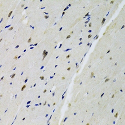 Invitrogen DOK1 Polyclonal Antibody 100 &mu;L | Buy Online | Invitrogen&trade; | Fisher Scientific