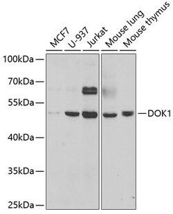 Invitrogen DOK1 Polyclonal Antibody 100 &mu;L | Buy Online | Invitrogen&trade; | Fisher Scientific