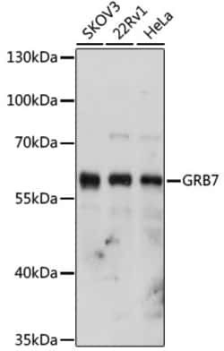 Invitrogen GRB7 Polyclonal Antibody 100 &mu;L; Unconjugated:Antibodies,