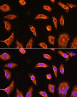 Invitrogen GSTP1 Polyclonal Antibody 100 &mu;L; Unconjugated:Antibodies,