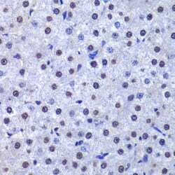 Invitrogen GSTP1 Polyclonal Antibody 100 &mu;L; Unconjugated:Antibodies,