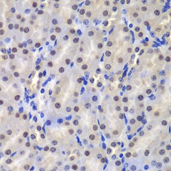 Invitrogen GSTP1 Polyclonal Antibody 100 &mu;L; Unconjugated:Antibodies,