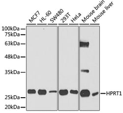 Invitrogen HPRT1 Polyclonal Antibody 100 &mu;L; Unconjugated:Antibodies,