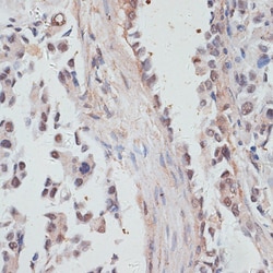 Invitrogen&trade;&nbsp;NCOA4 Polyclonal Antibody