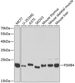 Invitrogen PSMB4 Polyclonal Antibody 100 &mu;L | Buy Online | Invitrogen&trade; | Fisher Scientific