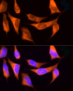 Invitrogen ROCK2 Polyclonal Antibody 100 &mu;L; Unconjugated:Antibodies,