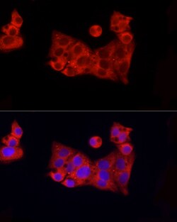 Invitrogen ROCK2 Polyclonal Antibody 100 &mu;L; Unconjugated:Antibodies,