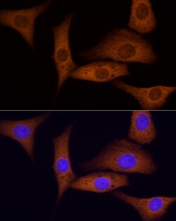 Invitrogen ROCK2 Polyclonal Antibody 100 &mu;L; Unconjugated:Antibodies,