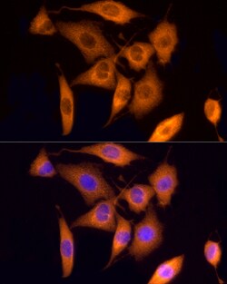 Invitrogen ROCK2 Polyclonal Antibody 100 &mu;L; Unconjugated:Antibodies,